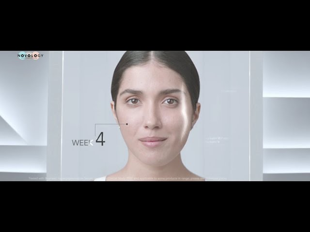 Novology - Clinically Proven Results | Costume Stylist by Rr 